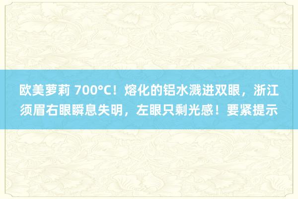 欧美萝莉 700°C！熔化的铝水溅进双眼，浙江须眉右眼瞬息失明，左眼只剩光感！要紧提示